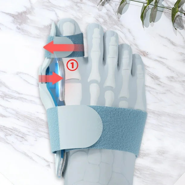 FlexAlign™ - Corrector Juanetes Con Placa Fijación 3 Ángulos